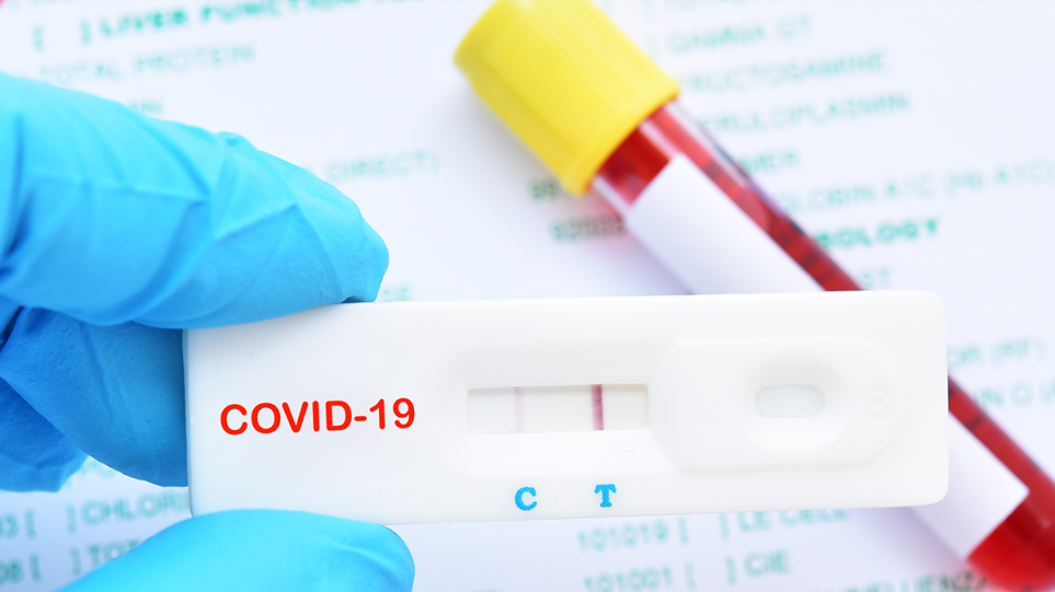CVIRUS RAPID TEST